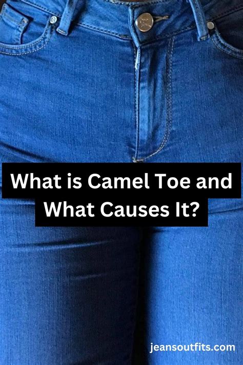 how to avoid camel toe in jeans|How to Get Rid of Cameltoe in Jeans